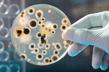 Anti-microbial resistance is fast emerging as a potential threat to human life across the globe and especially in developing nations.
