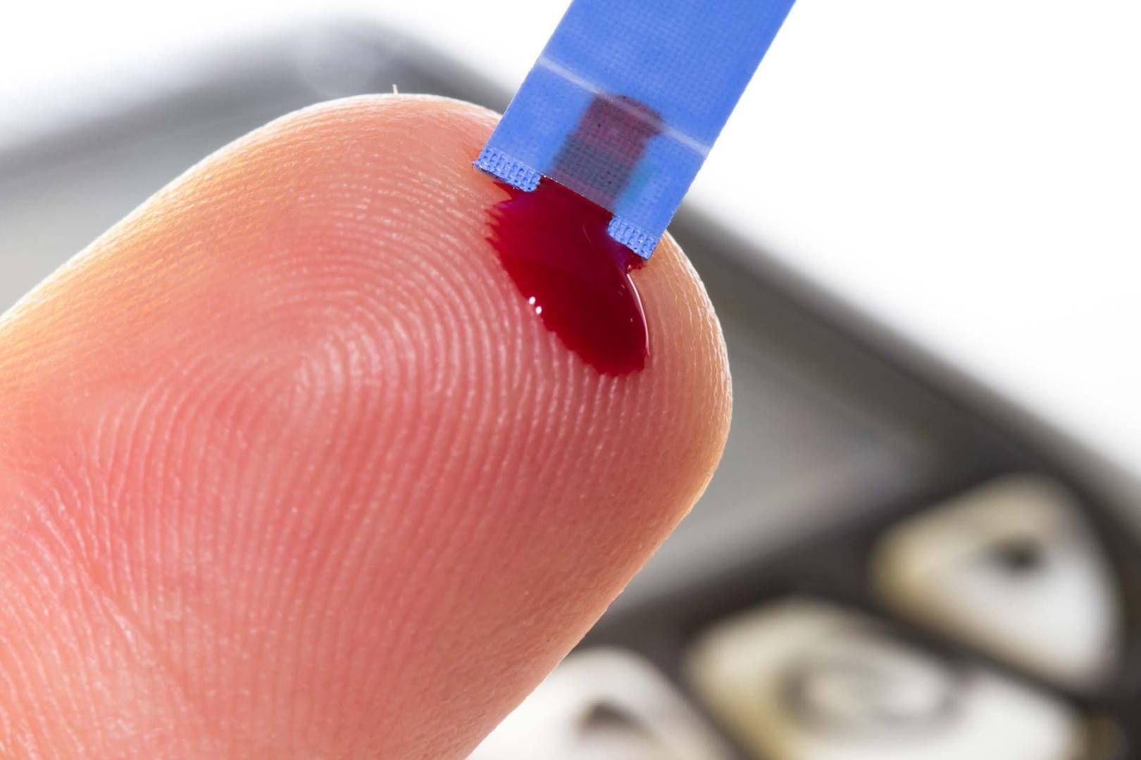 Precision Of Non invasive Blood Tests Depends On Skin Type