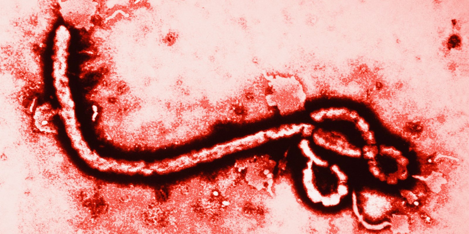 Indian Medical Association has been apprised to create awareness among its members on Ebola Virus Disease