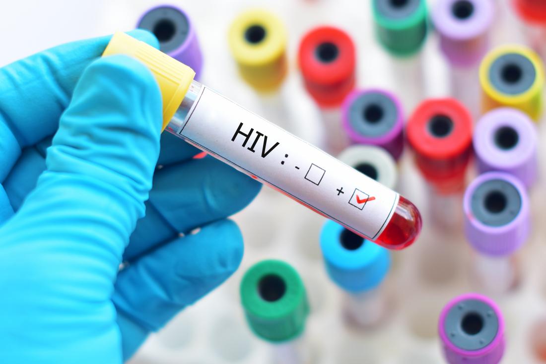 ViiV Healthcare’s Dovato Gets USFDA Nod To Treat HIV-1