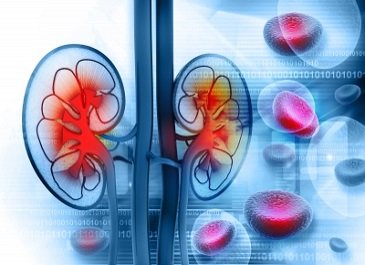 Bellco's portfolio bolsters Medtronic's legacy renal access business 