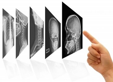 The solution can be tailored for radiology practices of all sizes and used with Philips imaging and informatics products 
