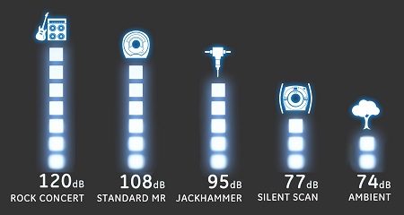 GE's Silent Scan technology dials down MRI scanning down to a whisper for patient comfort & reduces the need for re-scans