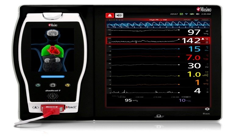 Root, a powerful new patient monitoring and connectivity platform  - Masimo's Product